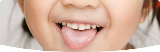 舌下免疫療法について